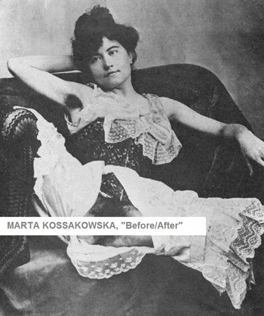 M. Kossakowska, Before/After