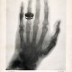 W.C. Röntgen, „Obraz dłoni prof. A. Von Köllikera wykonany przez W.C. Röntgena 23 stycznia 1896 r.”. Dzięki uprzejmości Deutsches Rontgen-Museum, Remscheid (źródło: materiały prasowe organizatora)