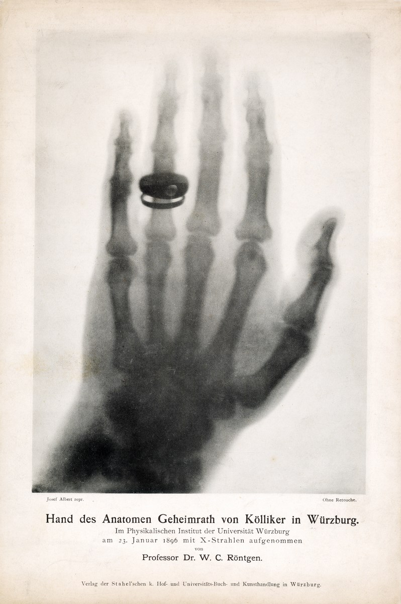 W.C. Röntgen, „Obraz dłoni prof. A. Von Köllikera wykonany przez W.C. Röntgena 23 stycznia 1896 r.”. Dzięki uprzejmości Deutsches Rontgen-Museum, Remscheid (źródło: materiały prasowe organizatora)
