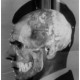 „Superprojekcja zdjęć i czaszki Josefa Mengelego”, Medico-Legal Institute labs, São Paulo, 1985. Dzięki uprzejmości Mai Helmer (źródło: materiały prasowe organizatora)