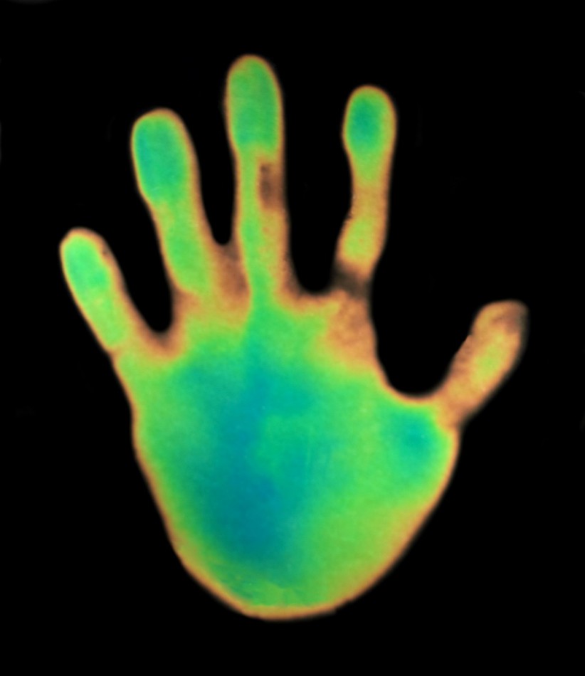 Termografia dłoni © Science Photo Library / East News (źródło: materiały prasowe organizatora)