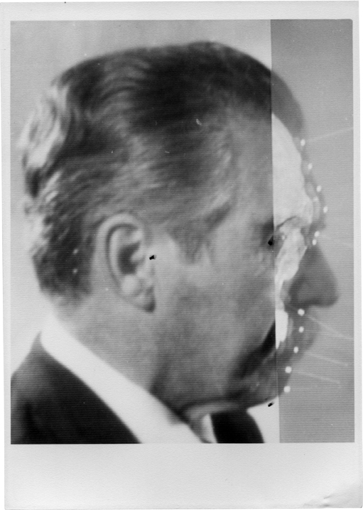 „Superprojekcja zdjęć i czaszki Josefa Mengelego”, Medico-Legal Institute labs, São Paulo, 1985. Dzięki uprzejmości Mai Helmer (źródło: materiały prasowe organizatora)