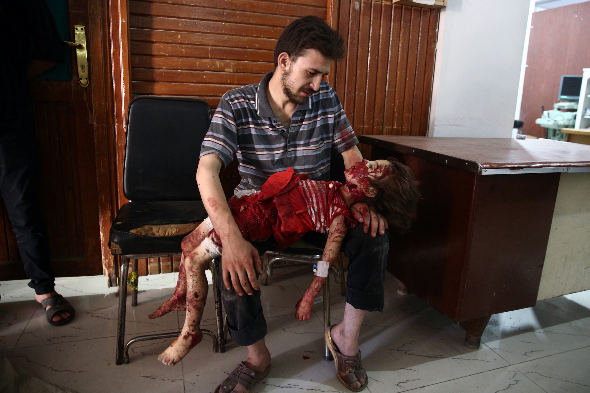 Abd Doumany, Syria, Agence France-Presse | „Douma’s children”, Syria, 2015Abd Doumany, Syria, Agence France-Presse | „Douma’s children”, Syria, 2015 (źródło: materiały prasowe)